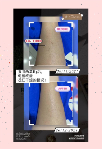 R3-testimonial_45-100